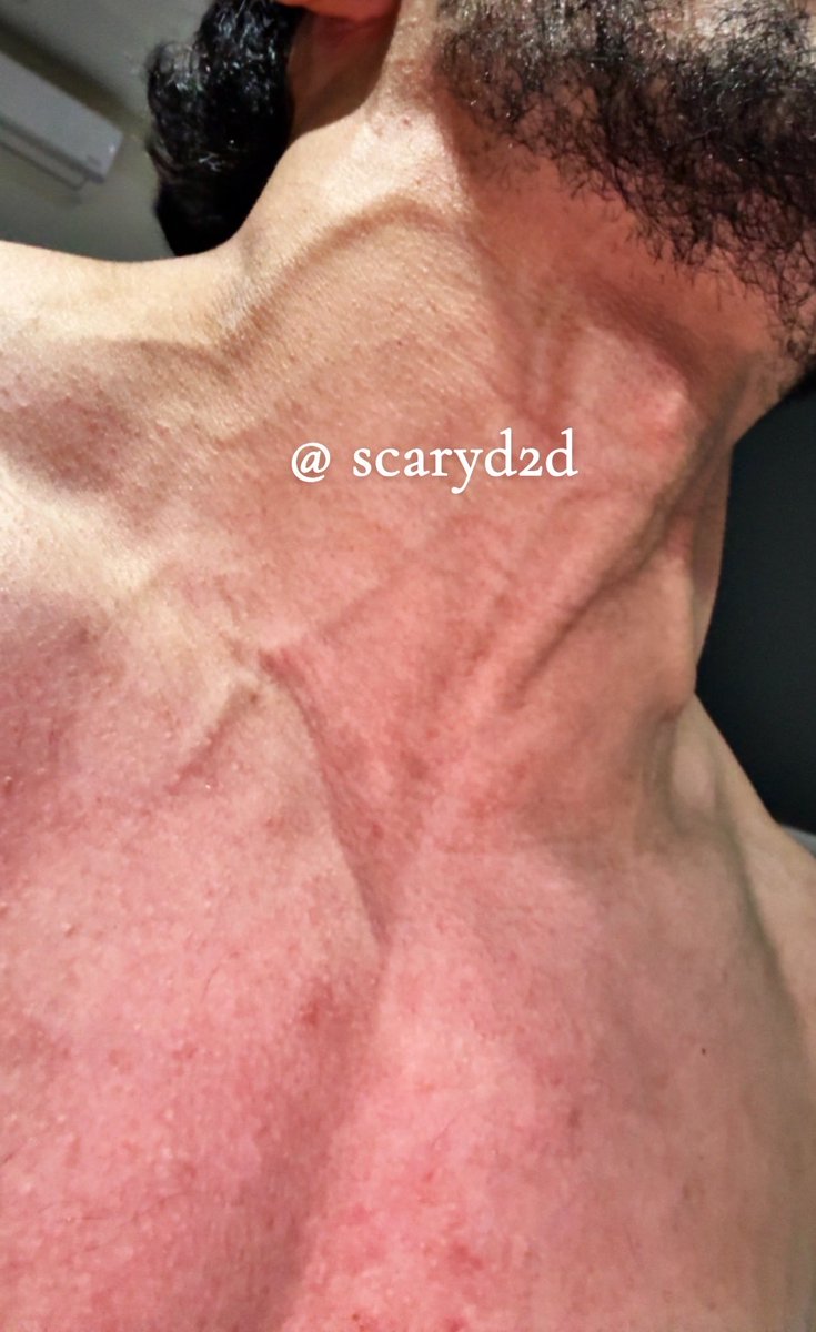 scaryd2d's tweet photo. new veins unlocked https://t.co/74D49kn39l