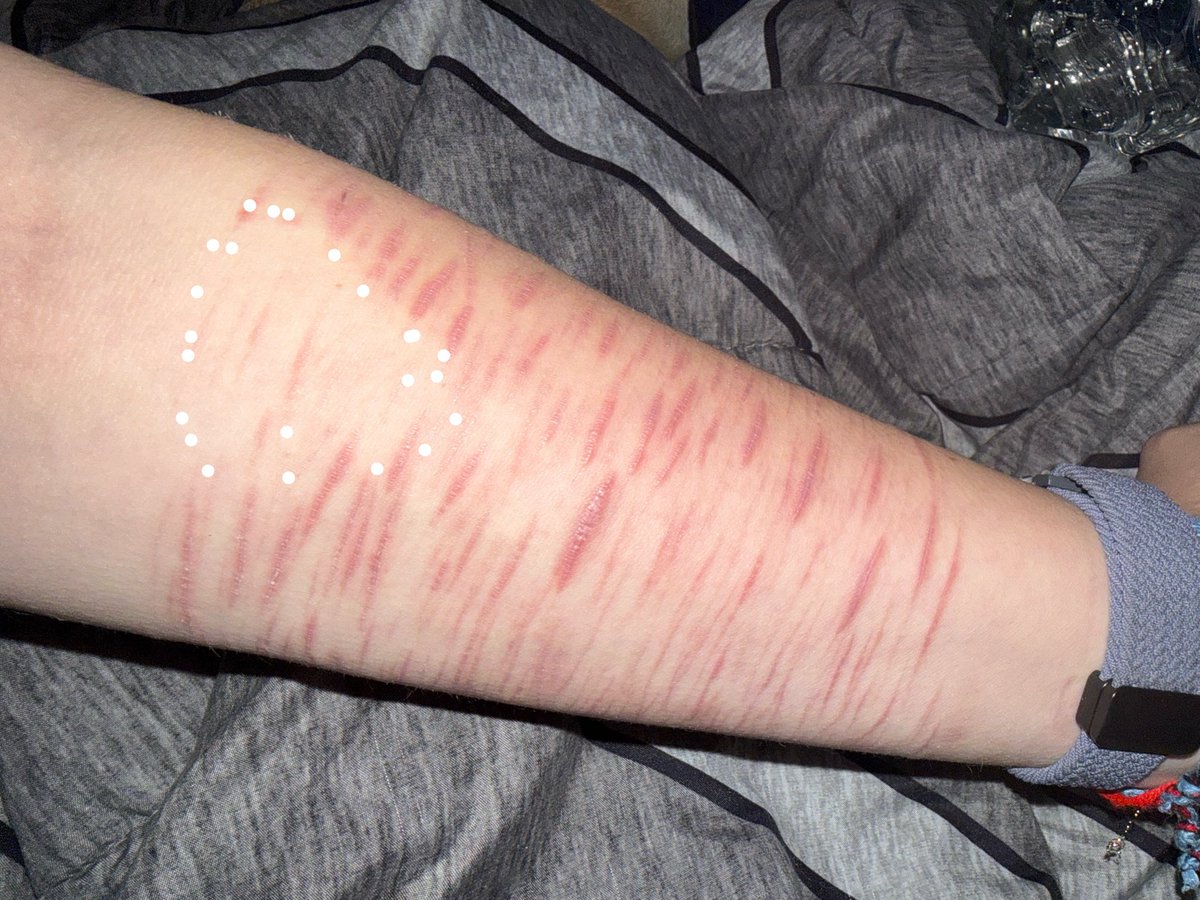 luka_swann's tweet photo. HEALED SCARS
ALL OLD 
NOT ENCOURAGING

this empty space is triggering me https://t.co/rYs2zT7yCV