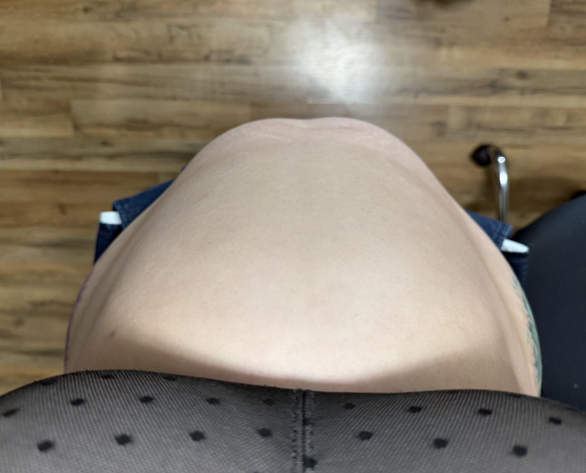 GumGumTum's tweet photo. Getting tighter… and uRp! Tighter… https://t.co/PlAaPndjJc