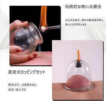 pencil53133's tweet photo. そりゃ伝統的な吸い玉のやり方でやってるから… https://t.co/yi6xdKWHUL