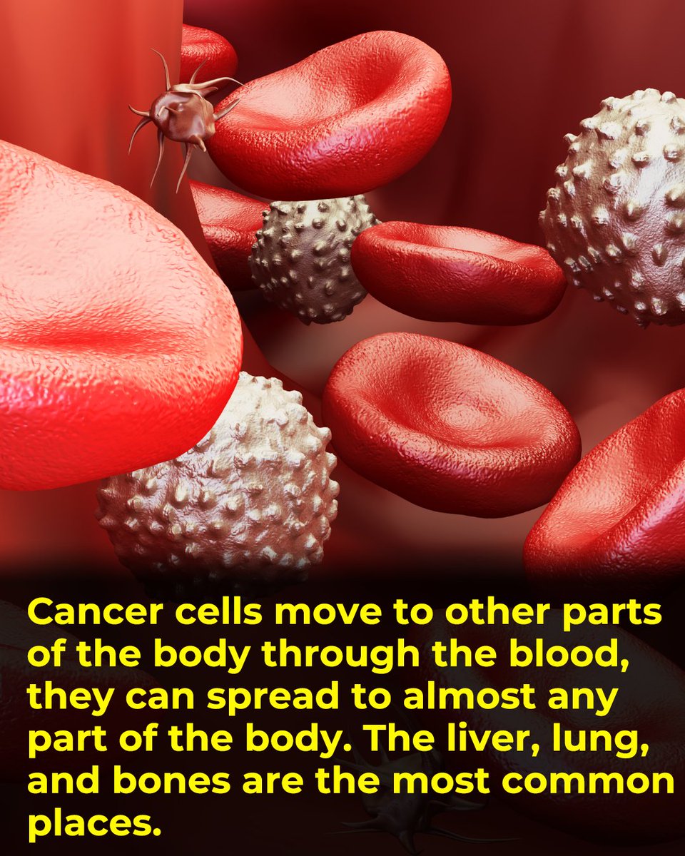 research_front's tweet photo. Cancer has no single cure because it isn’t one disease. It’s a collection of diseases that can occur throughout the body. Each type requires a different approach. As cancer grows and spreads, it can change, making treatment harder. https://t.co/uIik9qF3C6