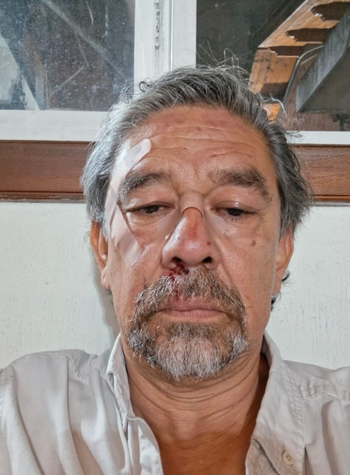 El_Imparcialgt's tweet photo. 🚨URGENTE ATACAN AL HÉROE NACIONAL VALENTIN DEL VALLE 

Circulan imágenes de agresión contra el héroe que enfrento  Sergio Morataya. 

Así responde el gobierno a la disidencia política, a la diferencia, a la libre expresión

ESTO NO PUEDE QUEDAR IMPUNE 

EL LLAMADO ES A UNIRNOS! VALENTIN SOMOS TODOS!
 
La pregunta es: 

¿Quién cree usted que cometió esta agresión?