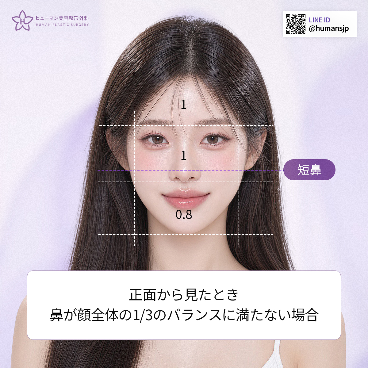 humanpsjp's tweet photo. 【ヒューマン美容外科】✨アップノーズ整形

鼻先の状態や皮膚・軟骨のバランスまでしっかり確認し、
自然な長さと角度になるよう一人ひとりに合わせてデザインします🩺

🇰🇷 韓国で鼻整形をお考えの方はお気軽にご相談ください🫶

💜LINE｜humansjp

#ヒューマン美容外科 #鼻整形 #アップノーズ https://t.co/qi8ZJSYSas