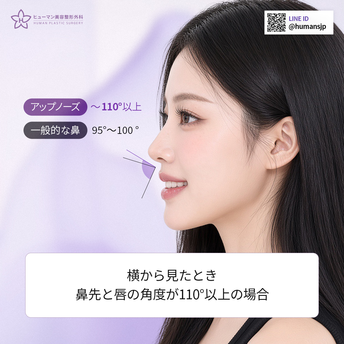 humanpsjp's tweet photo. 【ヒューマン美容外科】✨アップノーズ整形

鼻先の状態や皮膚・軟骨のバランスまでしっかり確認し、
自然な長さと角度になるよう一人ひとりに合わせてデザインします🩺

🇰🇷 韓国で鼻整形をお考えの方はお気軽にご相談ください🫶

💜LINE｜humansjp

#ヒューマン美容外科 #鼻整形 #アップノーズ https://t.co/qi8ZJSYSas
