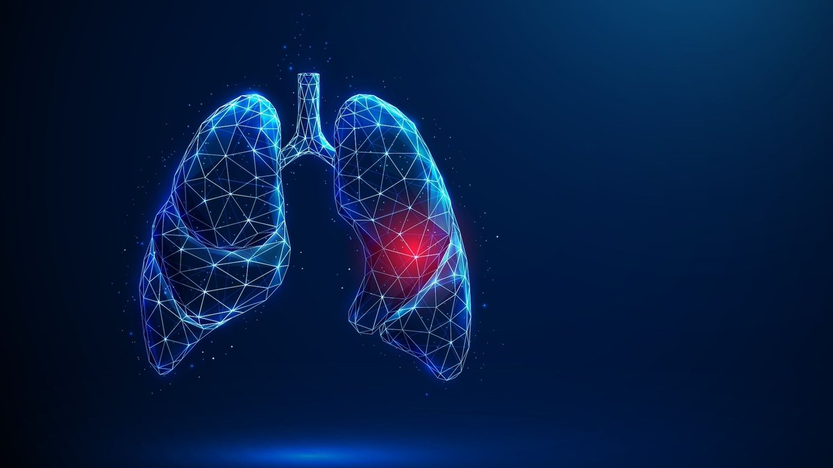LombardiaInnova's tweet photo. L'intelligenza artificiale per aiutare il medico a valutare con maggiore precisione quali pazienti potrebbero beneficiare dell’immunoterapia. È l’obiettivo di i3LUNG, progetto  coordinato dalla Fondazione IRCCS Istituto Nazionale dei Tumori di Milano👉
 https://t.co/5YRv6MpgID https://t.co/4IhJi20cQj