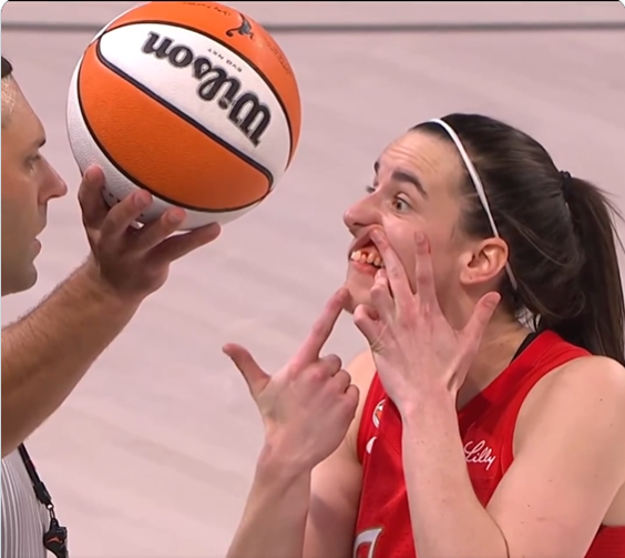 thesun_bd's tweet photo. Caitlin Clark was LEFT BLEEDING after contact with Jewell Loyd during Fever vs. Aces.

No foul was called.

Clark returned to the court, pulled down her lip, and literally showed the referee her bloody mouth. 😳

Still… no call. No review.

Clark later said: “Your guess would be as good as mine.”

Was this the right no-call? 👀

#CaitlinClark #WNBA #FeverRising