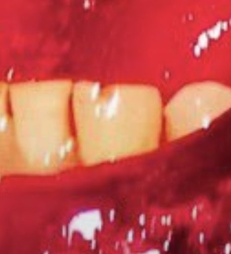 ashafriedpickle's tweet photo. thinking about her tooth chip https://t.co/2dxl7AZqx4