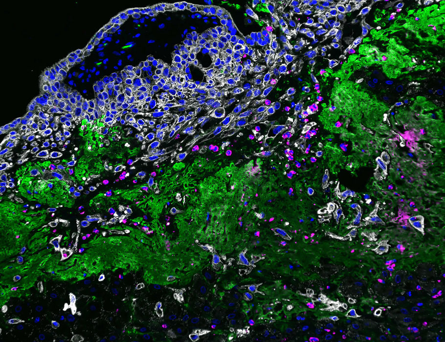 ScienceMagazine's tweet photo. A new @SciImmunology study highlights a neutrophil subset that accumulates in the placenta and promote trophoblast invasion to support early human pregnancy. https://t.co/kgoQwV07JO https://t.co/Amk5QB6C4q