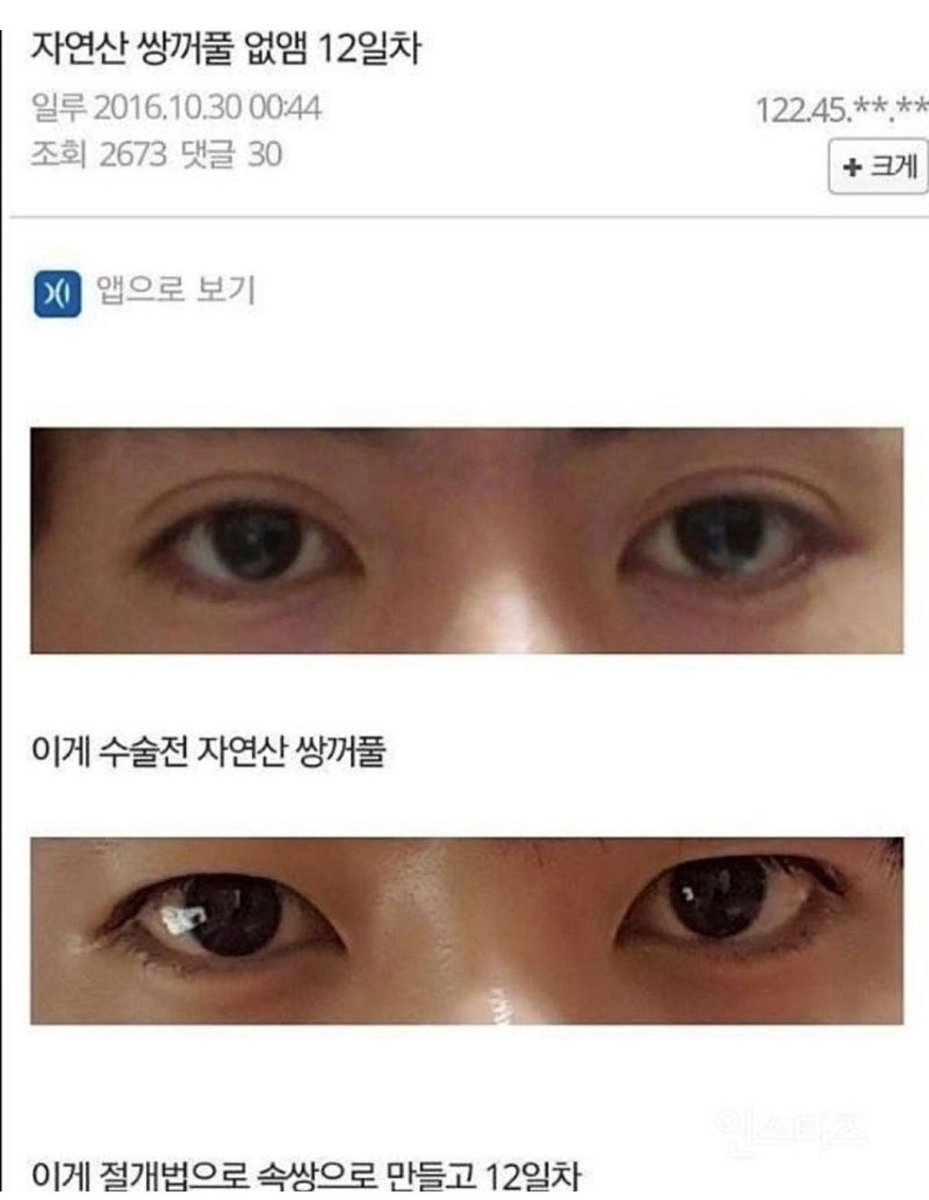 10Billionaire_A's tweet photo. 자연산 쌍커풀 없애는 수술한 디시인

박보검 눈이 됨; https://t.co/BlE7Eb9Olt