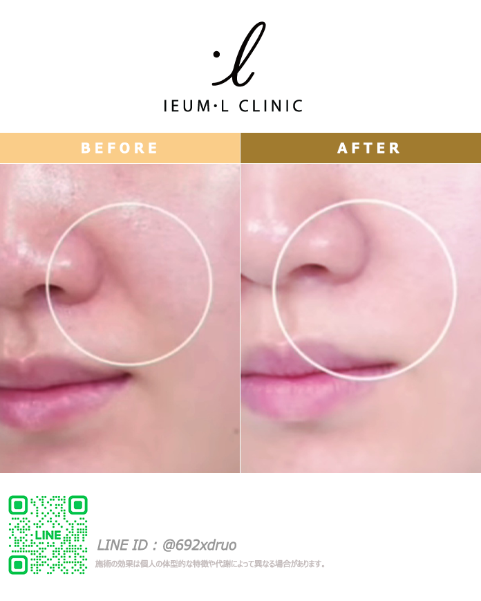 ieumlclinic_jp tweet picture