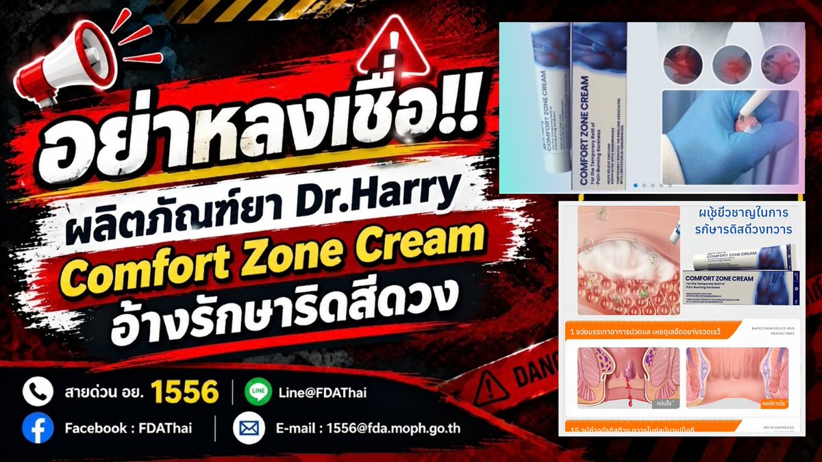 fdathai's tweet photo. อย. เตือน อย่าหลงเชื่อ !! ผลิตภัณฑ์ยา Dr.Harry Comfort Zone Cream อ้างรักษาริดสีดวง ระบุข้อความโฆษณา “7 เห็นผล ริดสีดวงหายเกลี้ยง...ไม่หายยินดีคืนเงิน 100%... ” จากการตรวจสอบพบโฆษณาแสดงคุณประโยชน์ คุณภาพ หรือสรรพคุณของผลิตภัณฑ์อันเป็นเท็จหรือหลอกลวงให้เกิดความหลงเชื่อโดยไม่สมควรและไม่พบการขึ้นทะเบียนเป็นผลิตภัณฑ์กับ อย.

สามารถติดตามข่าวสารดี ๆ ต่อได้ที่ >>https://t.co/YmcRgWtX0l

ไม่อยากพลาดข้อมูลข่าวสารสุขภาพดี ๆ จาก อย. มาเป็นเพื่อนไลน์กับเราได้ที่ TikTok : @FdaThai