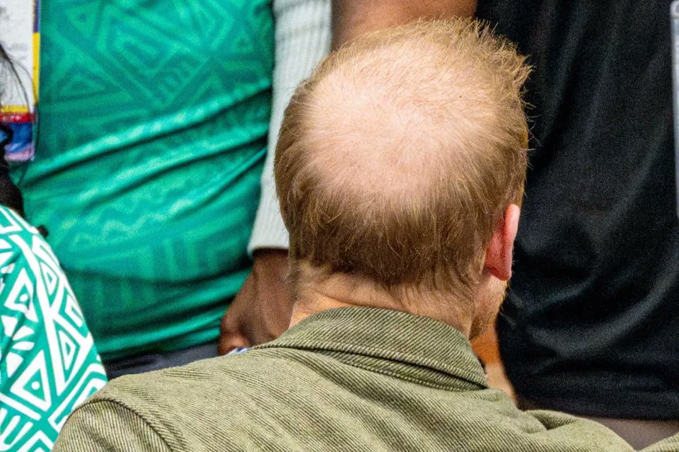 JonathanGunson's tweet photo. @Mulugold Re 'Bald William': Sighting of 'The Spare' last week. https://t.co/jiOWJgN3CV
