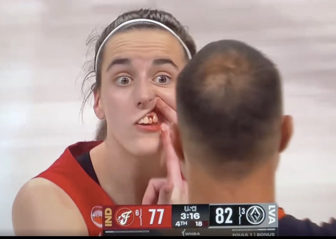 YoitsRosie's tweet photo. When there no foul on this you start feeling like there’s something shady going on. Hate to say it 😂 https://t.co/I4YSmJ4gAo
