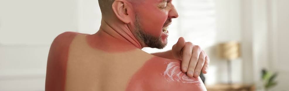 soca_de_bopa's tweet photo. @kakszaks @snorenik @mugislover super pale people when they """tan""" https://t.co/jo440DiHqQ