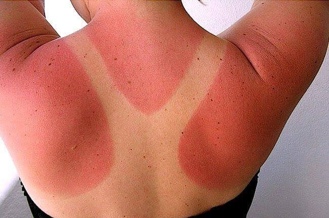soca_de_bopa's tweet photo. @kakszaks @snorenik @mugislover super pale people when they """tan""" https://t.co/jo440DiHqQ