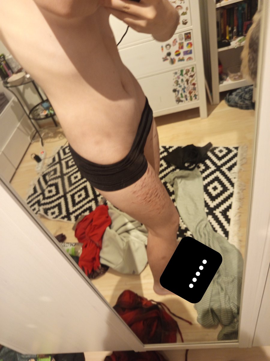 ZAVian89's tweet photo. Body check bmi 19.1. Also does this count as a thigh gap or do i need to work on that more. #edtwtt #averagespo https://t.co/0kgLjhD3hO