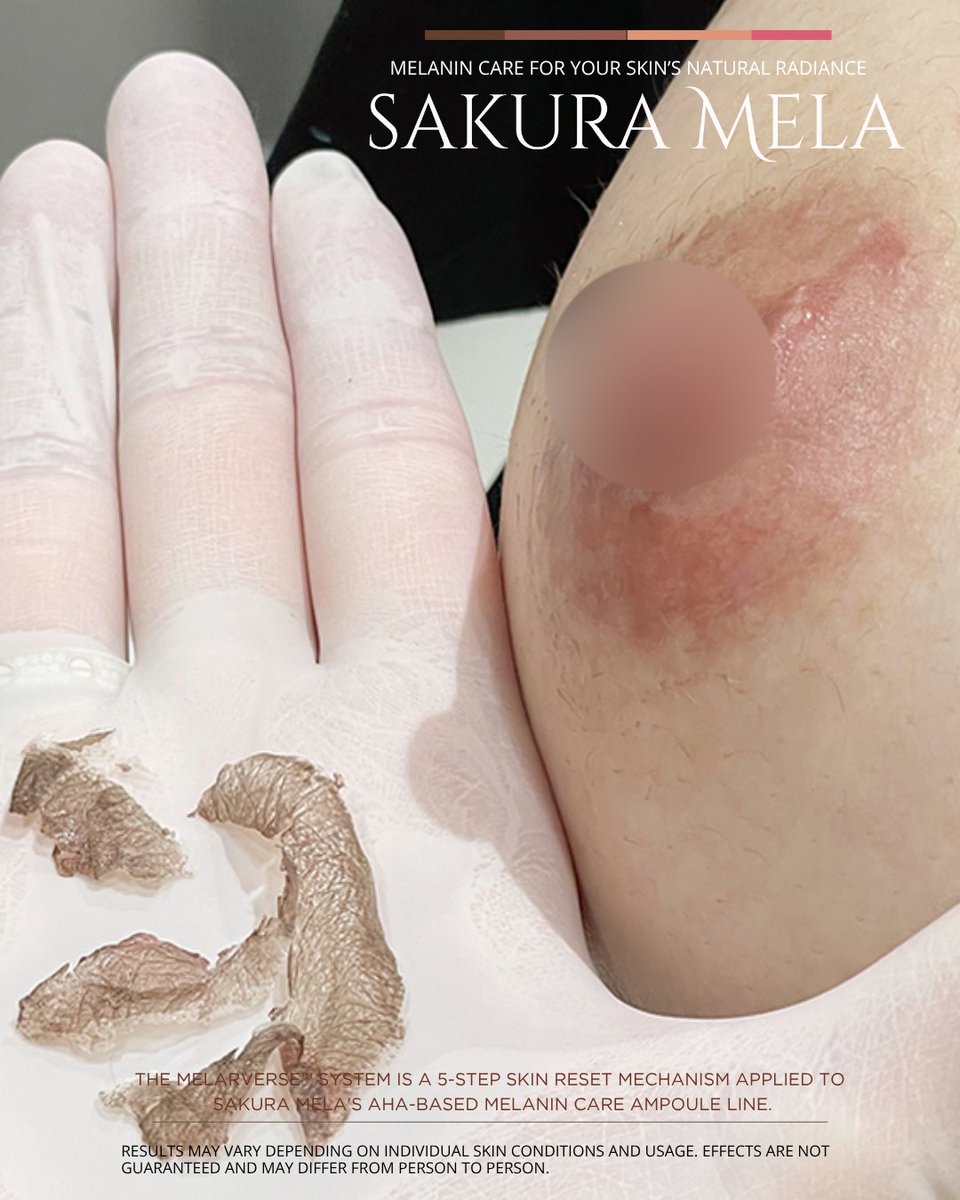 browbibi_'s tweet photo. 気になるくすみや色ムラをケアして、明るく透明感のある印象のお肌を目指しませんか？✨
透明感あふれる肌へ🌙🌸
#バストケア #メラニンケア #黒ずみ解消 #色素沈着 #SAKURAMELA  #美白ケア #サクラメラ #sakuramela
#韓国整形 #韓国 #肌ケア #黒ずみ #メラニン色素  #スキンケア #乳首ケア https://t.co/JOxeRNl9uz