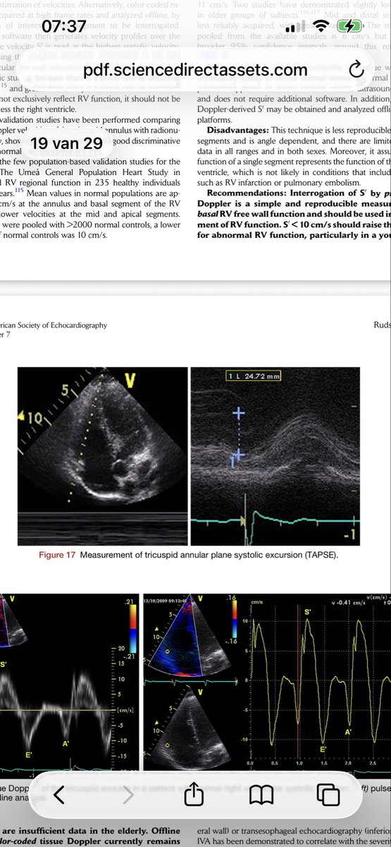 echo_batman's tweet photo. @Becho2106 @BiancaJudyC @iamritu @NMerke @DocStrom @dr_benoy_n_shah In this reconnendarion documenr from 2010, they say 4CH view, but the example shown is a focused RV view … https://t.co/EwydObDWlC