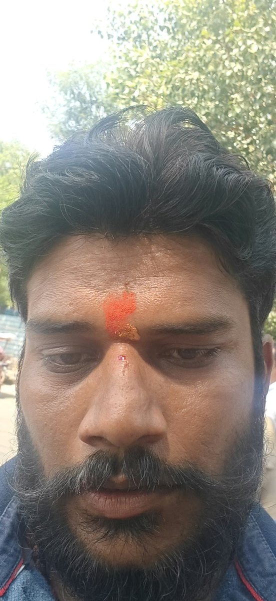 Naveen_Path1711's tweet photo. पंकज धवरैय्या की पदयात्रा रोककर दिल्ली पुलिस ने की मारपीट सबकी गिरफ्तारी की गई पंकज धवरैय्या जी की नाक से खून निकला
जैसा जैसा 11 अक्टूबर पास आ रहा है दिल्ली पुलिस क्यूपीएन रंग दिखा रही हैमोदी जी ने फिर दिखा दी तानाशाही 

21 वे दिन पंकज धवरैय्या की पदयात्रा करोलबाग DCM चौक पर रोकी गई 
वाह दिल्ली पुलिस शर्म करो।
@DelhiPolice 
@CMRekhaGuptaFC 
#UGCReservation 
#SCSTएक्ट 
#ReservationReform