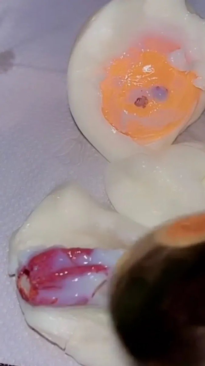 zanecarternb's tweet photo. I was just peeling my boiled egg like normal… then I came across THIS.

For a second, I genuinely thought I had somehow cracked open an egg that had another egg growing inside it. I kept poking at it because WHAT am I looking at?

Has anyone else ever seen an egg do something like this?