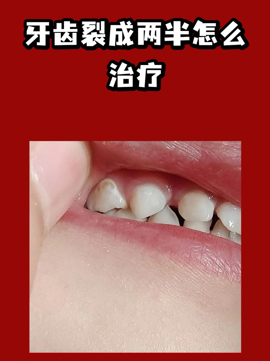 CrazyDefenvhbo's tweet photo. [A row of teeth shows tiny wounds, quiet yet clear—small hurts hold big stories. Keep smiling gently, you’re doing fine.]， https://t.co/0i56xZFePk