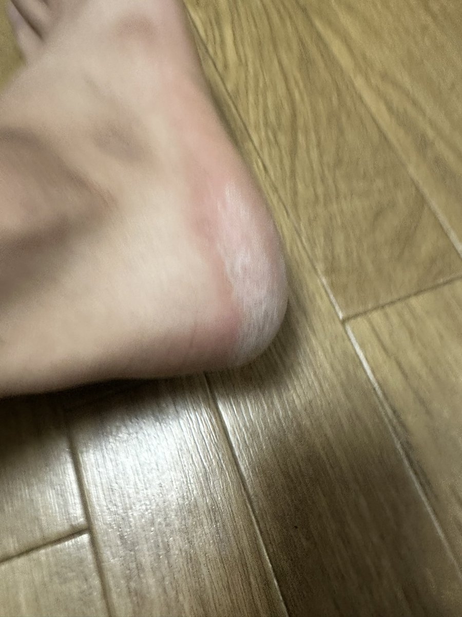 Shota1325's tweet photo. かかとケアで大事なのは 「高い道具を買うこと」じゃない。
¥173のこれで十分。 当てて軽く動かすだけで、角質が白い粉みたいにポロポロ取れる。
ただ、削れすぎる。 俺は削った境目が少し赤くなった。

だから ・力は入れない ・削りすぎない ・終わったら保湿
 この値段で��れは優秀。 https://t.co/BihS29rzw2