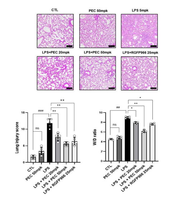 antioxidants_OA's tweet photo. ๐ฟ Can a natural flavonoid help protect against lung inflammation?
Pectolinarigenin Attenuates LPS-Induced Lung Inflammation and Injury with Reduced HDAC3/NF-ฮบB/NLRP3 Signaling
โ๏ธ Danbee Kim, et al.
๐ https://t.co/tLC45d6J9E
#Antioxidants #LungInflammation #OxidativeStress https://t.co/lqZXZhMp5c