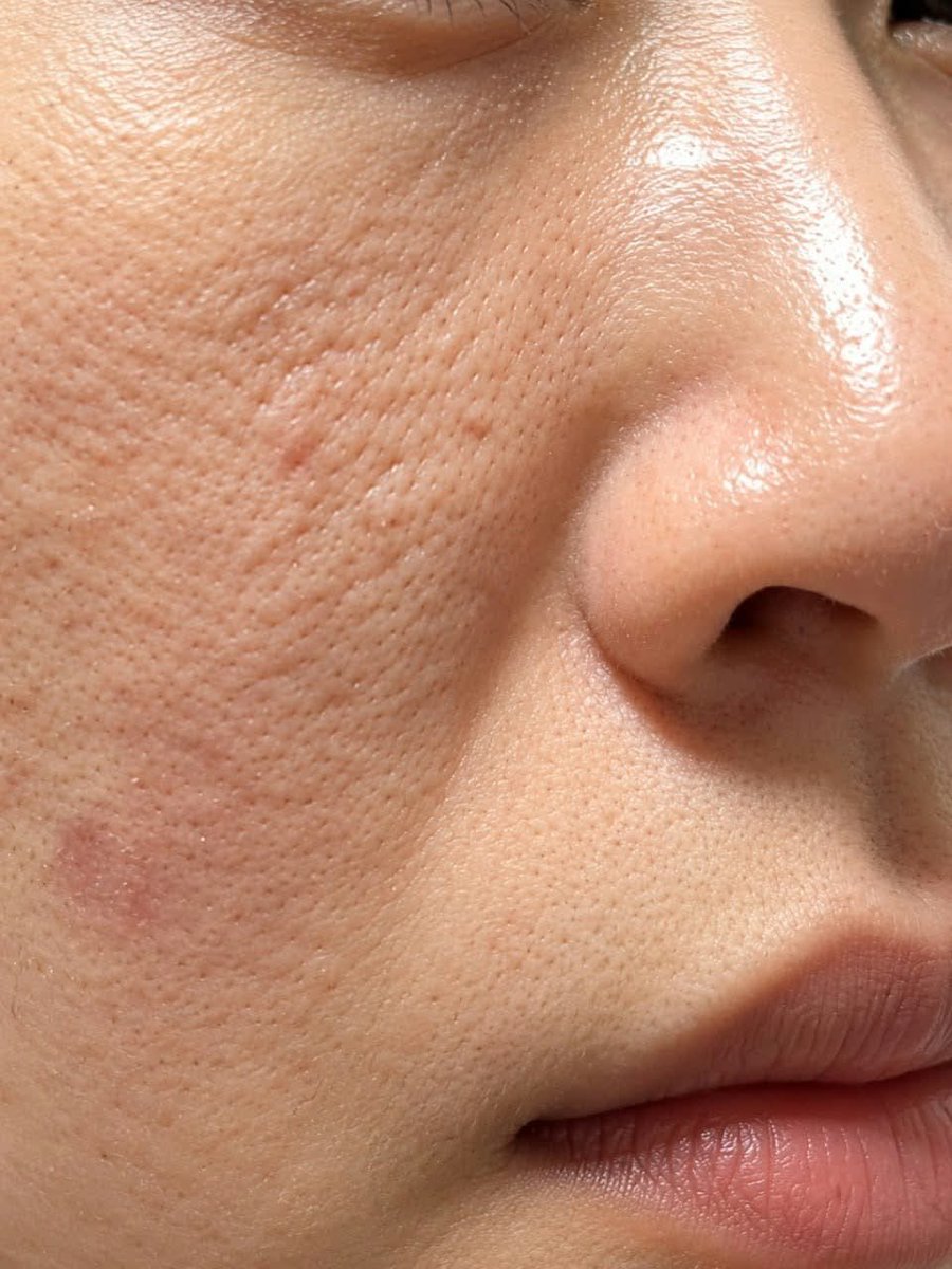 thinkewart's tweet photo. I wish I kept the note with that facialist's name because she totally fixed my mature skin's worst issues ✨🤍
tbh the serum made my pores look so much better 🫶 #ad 👉 https://t.co/Bkpmk7rHe2 https://t.co/3ClNEwYdo6