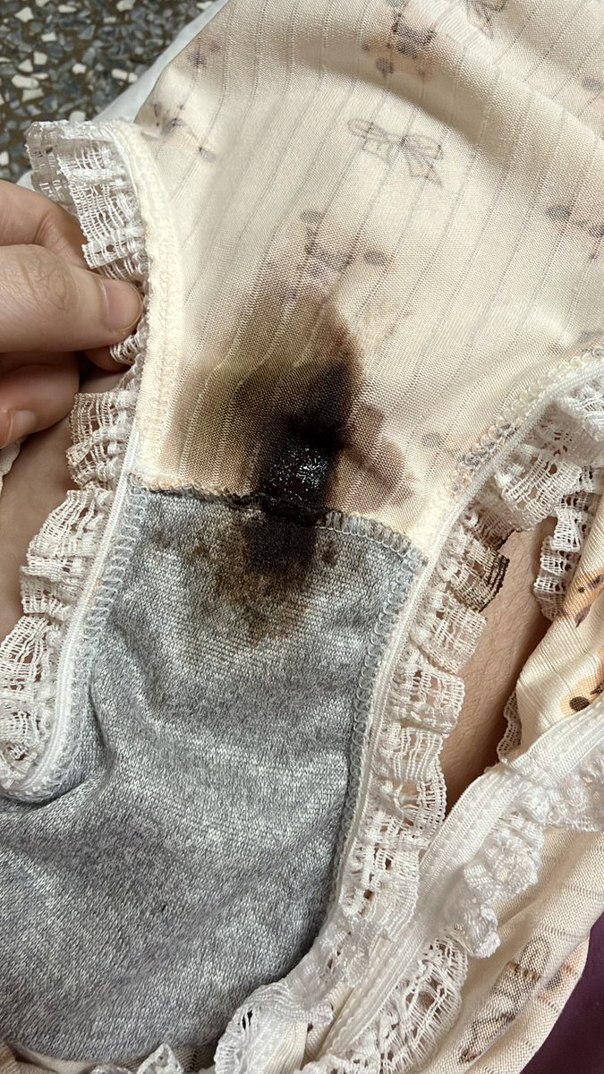 yxun167927's tweet photo. 最近的褲褲好重口好香💗😳
（分泌物深色是正常現象）

https://t.co/ahwuFpFOhO

#原味 #破洞襪 ＃原味內褲
#瑜萱原味 #學生原味 #客製化影片
#私密群 #原味內衣 #原味內褲 #淫水 #分泌物 https://t.co/1BxIKVBfzt