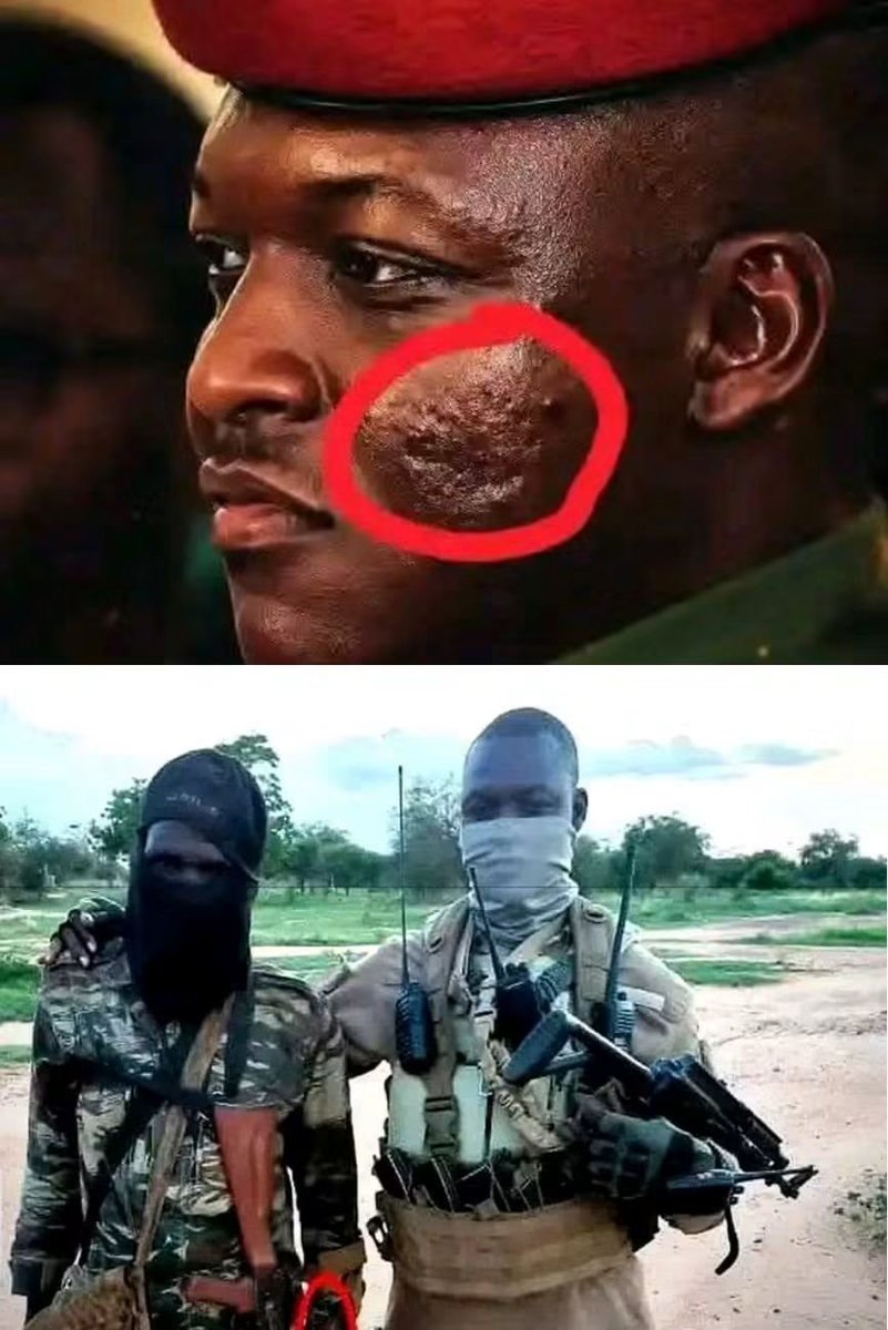 beyondB_DAG's tweet photo. The Man who almost lost his jawbone defending the Mali and African from Western sponsored terrorists.  

Today he is called a junta leader,  whilst the leader of the terrorists he fought are called "Transational President ".

If you want to protect your sanity and mental health fellow Africans, then avoid Western press.

Western imperialist leaders and their press, are too side of the same coin.

You can't hate imperialism and want to decolonise, and at the same time read Western press, it is live a rehabilitating or recovering alcoholic going to a pub.