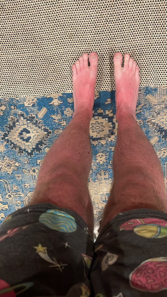 LucaHayesX's tweet photo. Got some sun https://t.co/ZTvgYSeRCW