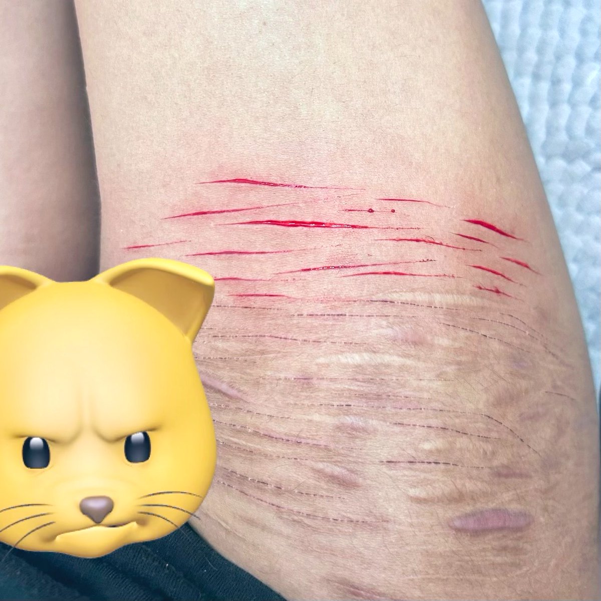 Fatal4lyfe's tweet photo. Both thighs and my wrist tonight🙃
#shtwt #catscratch #styro #sfxmakeup #fake #moothunt〃・ https://t.co/ciqvNJ1HJG