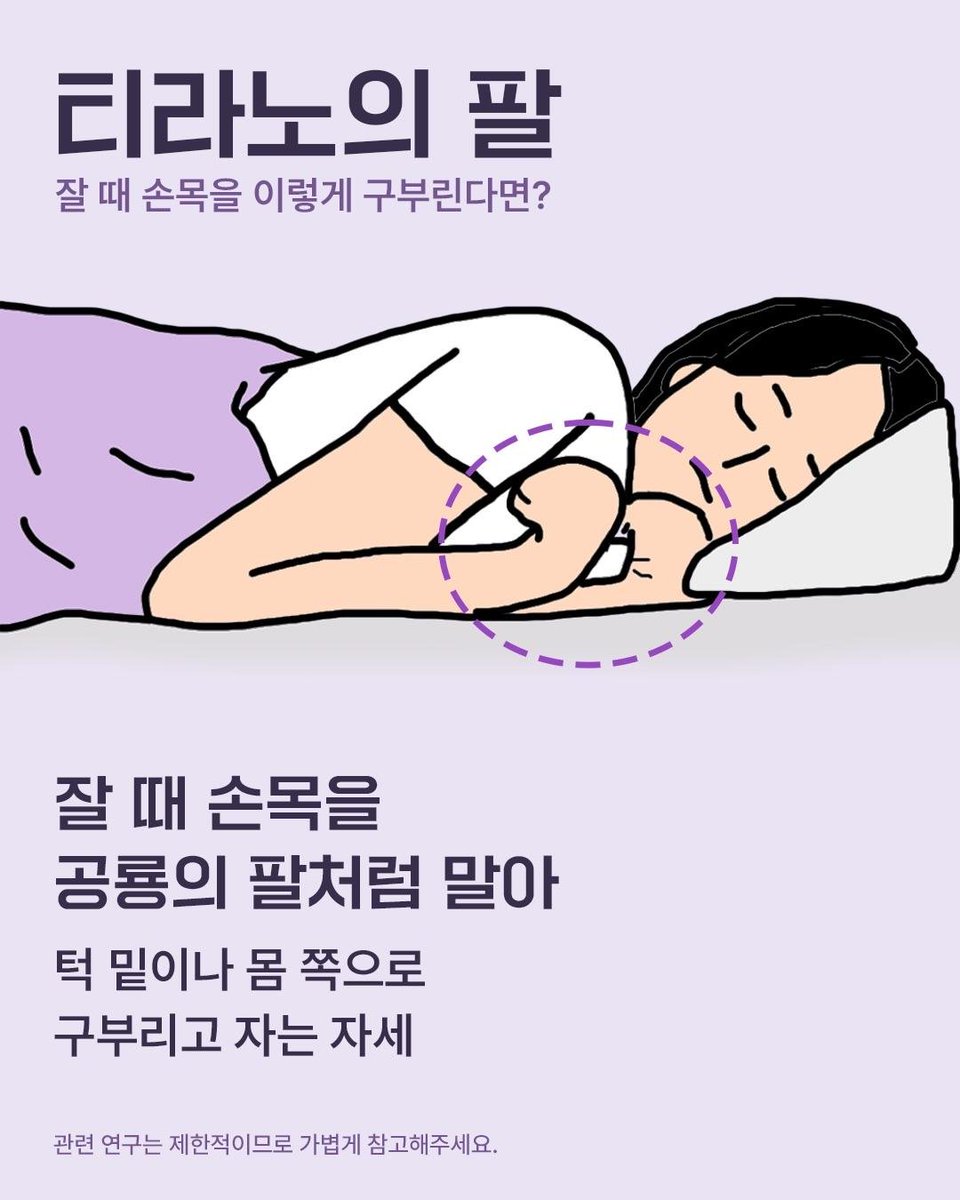 0hhhaaapppyy0's tweet photo. 자고 일어나면 손목 꺾고 팔 접은 채 자고 있는
 ‘티라노 자세(T-Rex Arms)’ 하는 사람? 🦖

​무의식중에 급소를 감싸 심리적 안정감을 찾으려는 본능이라는데, 감각이 예민하거나 요즘 스트레스 많은 사람들한테 자주 보인다고 함.

​편하긴 한데 장기적으론 손목·팔꿈치 터널증후군(손 저림) 올 수 있으니, 포근함 못 잃겠다면 바디필로우나 인형 하나 품에 안고 자는 걸 추천.