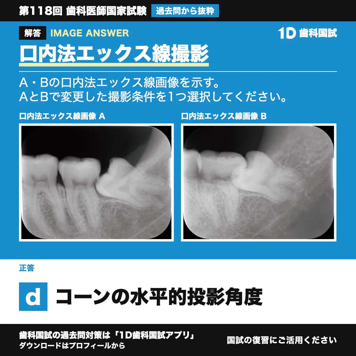 1D歯科医師国家試験 (@dental_study) / X