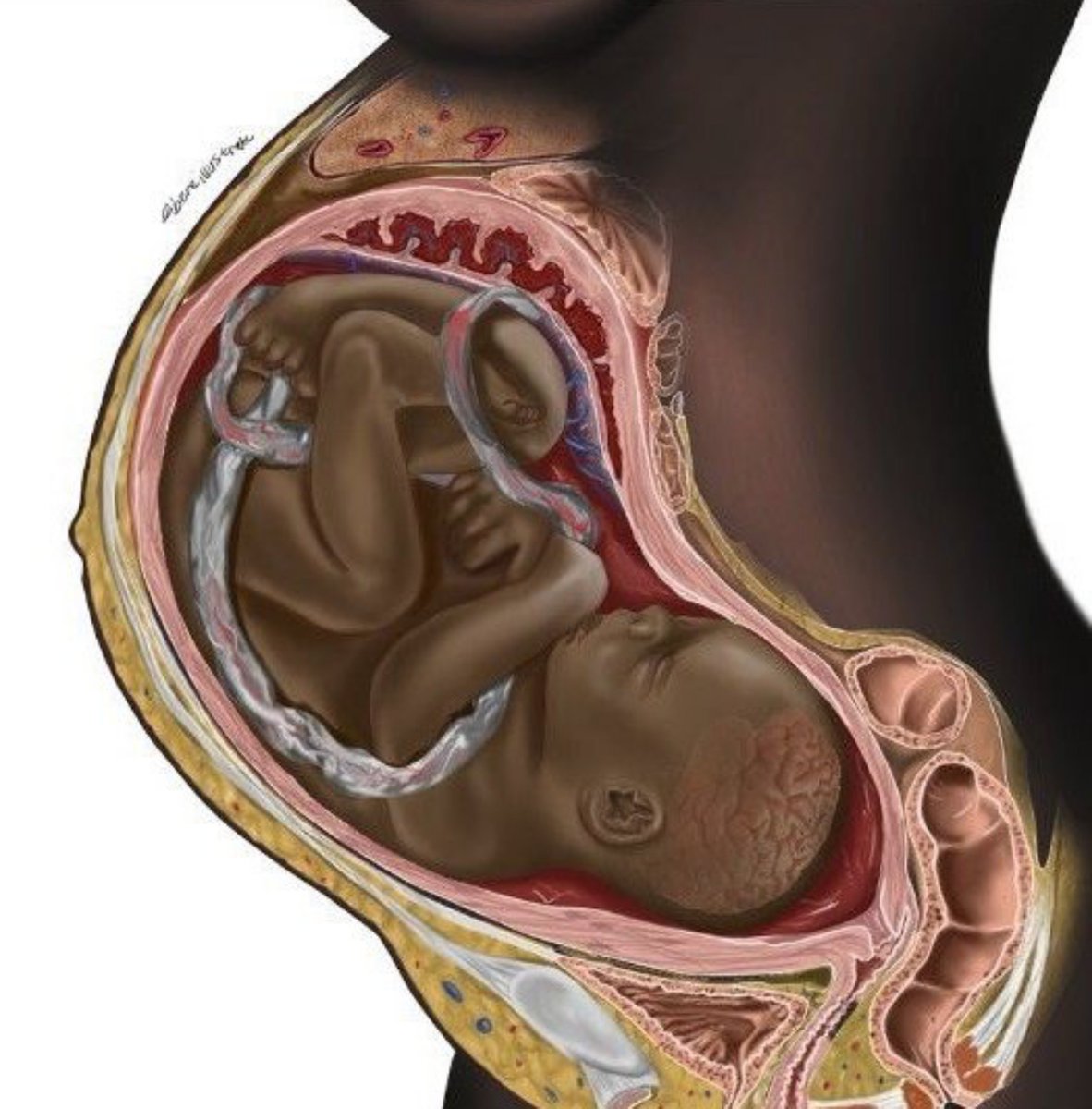 IgboHistoFacts's tweet photo. Meet Chidiebere Ibe.

A medical illustrator from Ebonyi State, challenging White-only medical diagrams and bringing Black representation to global medical textbooks.

Let’s retweet to celebrate him! ✨ https://t.co/yNQmIVk659