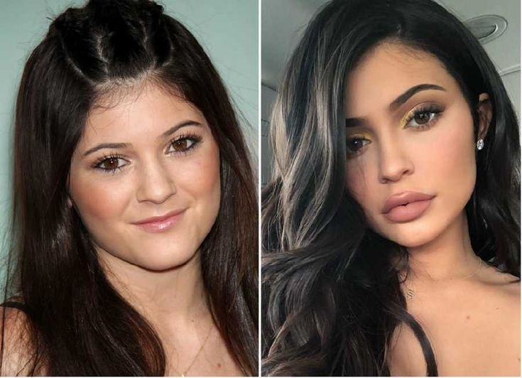 MannyAsks's tweet photo. Kylie Jenner is basically a live demonstration of what modern cosmetic surgery can do. https://t.co/AbgTDb5Djm
