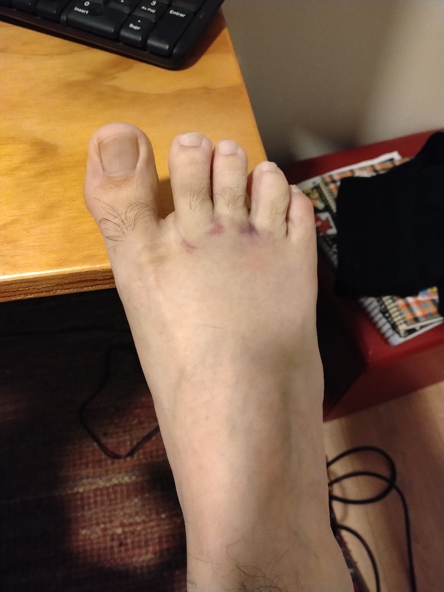 seanvasbarrera's tweet photo. 🤕 https://t.co/sDeXNtbKfr