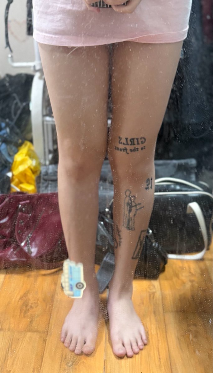 chronicalorie's tweet photo. everyone pls applaud for my very humble thigh gap 💔 https://t.co/5qGpuyFnXy