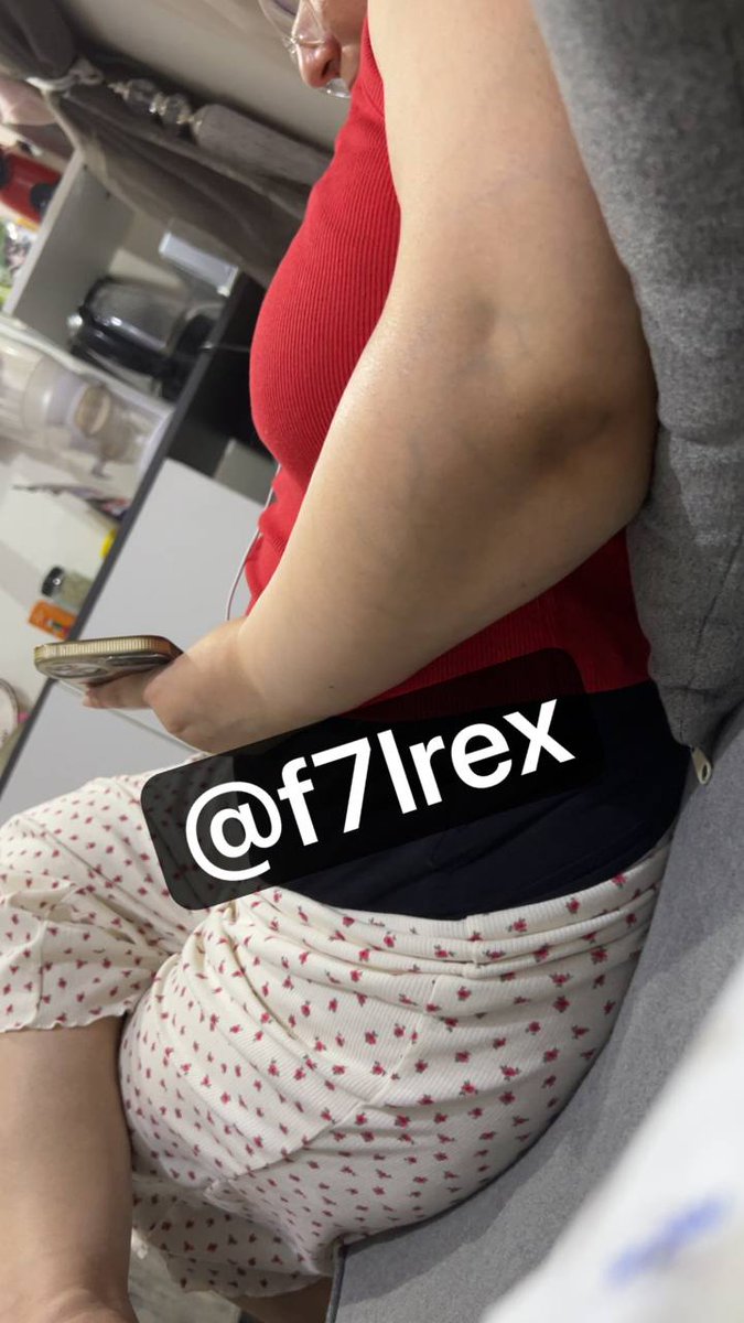 f7lkmrex's tweet photo. فاككك المطيزه والمشحمة السبيعية تذبحح 😵‍💫😵‍💫🍑 https://t.co/82OB2JsM71