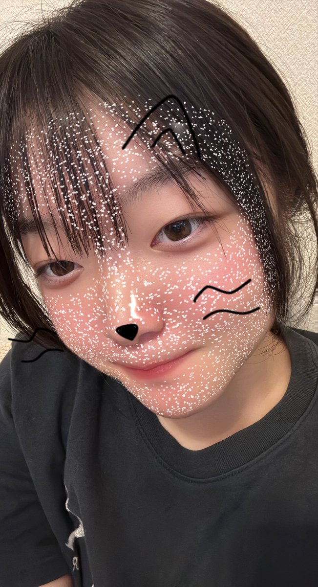 4ngel___3's tweet photo. 唇荒れまくってていたい😭😭😭😭 https://t.co/TceaeIBD5L