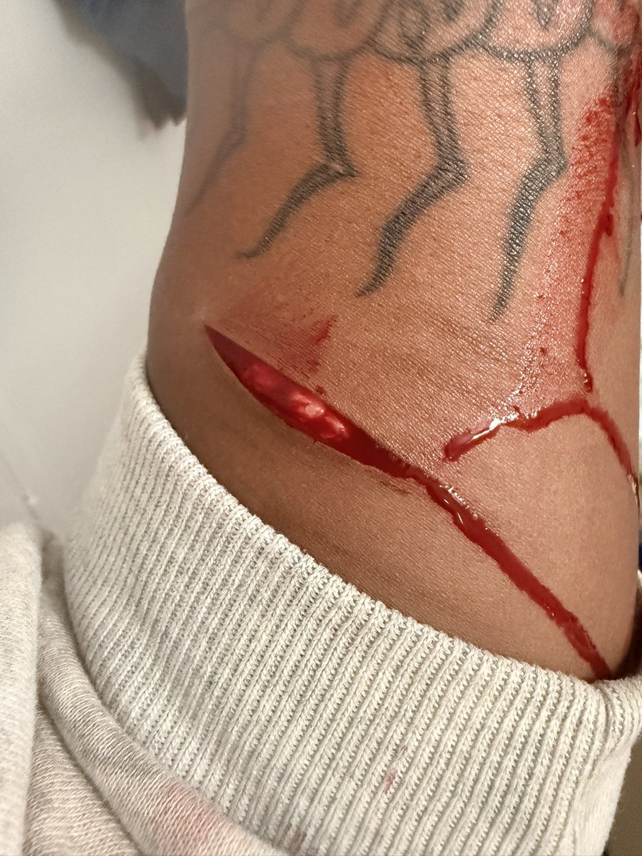 Queenofsaygon3's tweet photo. I tried to kill mysslf in my friends house and failed #FAKE #HorrorMakeup
#HorrorMakeupArtist
#SFXMakeup
#SFXMakeupArtist
#SpecialEffectsMakeup #oomf #shedtwt #beans https://t.co/anGvwRCPPr