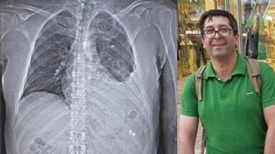 EpicFuryIran's tweet photo. #HamidQarehHasanlou, a doctor, marched with Iran's 2022 protesters. Still, he treated a wounded Basij member, because that's what a doctor does.

His thanks? Charged in the man's death, tortured, jailed, &amp; denied care.

A regime that punishes mercy must end
#EndTheIslamicRepublic https://t.co/HjV7QkJnO9