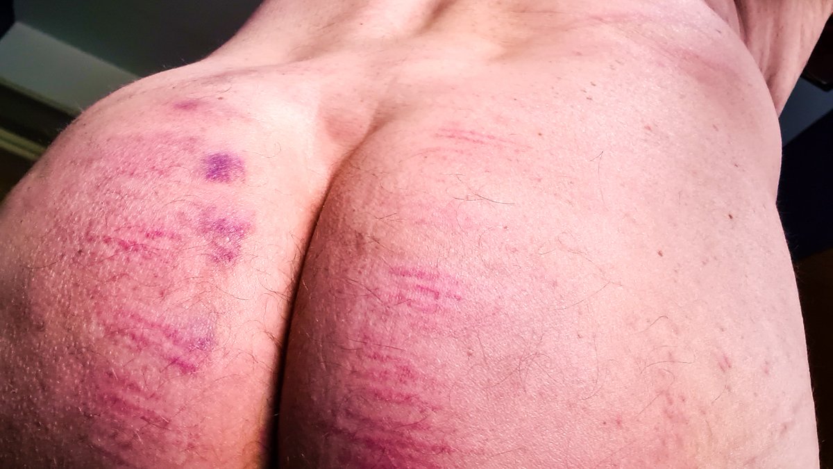 boototter's tweet photo. To spank or to be spanked, what do you like? I enjoy both sides. It's the choice between red palms or red buttocks.
#gaybdsm #SpankingKink #ImpactPlay #spanking https://t.co/ElUdKUAt3t