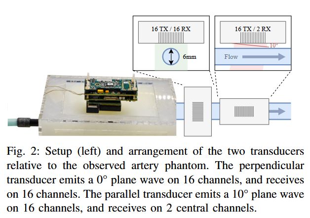 pulp_platform's tweet photo. Our "Open-Source Live-Reconfigurable Multi-Mode Wearable Ultrasound" paper presents a transition-aware control stack for enabling low-latency, in-session reconfiguration of multi-mode wearable ultrasound systems. Implemented on 32-channel TinyProbe, see https://t.co/BGVjISc8L3 https://t.co/t3414xQ7Cy