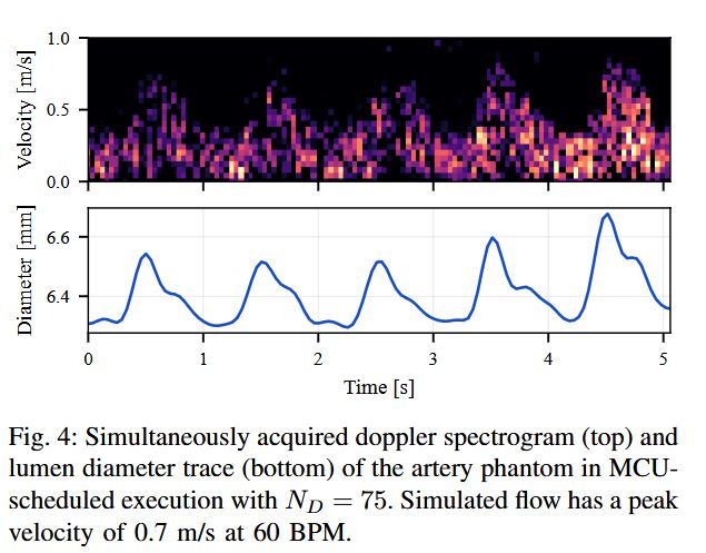 pulp_platform's tweet photo. Our "Open-Source Live-Reconfigurable Multi-Mode Wearable Ultrasound" paper presents a transition-aware control stack for enabling low-latency, in-session reconfiguration of multi-mode wearable ultrasound systems. Implemented on 32-channel TinyProbe, see https://t.co/BGVjISc8L3 https://t.co/t3414xQ7Cy