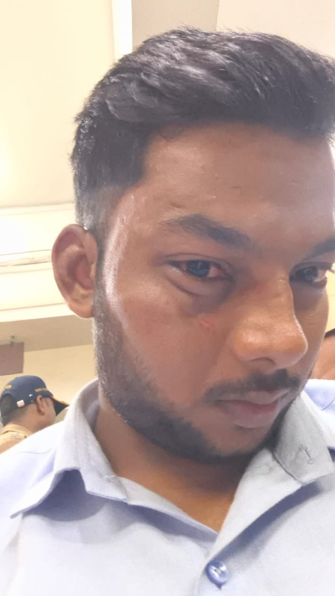 SanjayYada7n's tweet photo. 3 UNKNOWN PERSONS. SERIOUS INJURIES. AND A VERY SIMPLE QUESTION - WHAT ACTUALLY HAPPENED?

Rahul Yadav is our former employee.

On 30 Sept 2026, around 6:30 PM, he was allegedly assaulted in Kurla West.

The NCR filed at Vinoba Bhave Nagar Police Station says:

📄 NCR No. 1923/2026
👤 3 unknown persons
⚖️ BNS 115(2) & 352
⏰ Incident: 6:30 PM

But his medical documents record injuries including:

➡️ Significant injury/swelling around the right eye
➡️ Facial injuries
➡️ Reduced hearing in the right ear
➡️ ENT findings requiring follow-up

And Rahul says more people were involved.

So here’s the uncomfortable question:

If CCTV cameras were around the area, why shouldn’t the CCTV simply settle the question of WHO was there and WHAT happened?

No social-media trial.
No assumptions.
No naming innocent people.

JUST INVESTIGATE.

@MumbaiPolice @CPMumbaiPolice

Please:

🔴 Preserve & examine CCTV footage
🔴 Identify everyone involved
🔴 Record witness statements
🔴 Examine the medical & ENT reports
🔴 Establish the actual sequence of events
🔴 Take appropriate legal action based on the evidence

A case shouldn’t become “3 unknown persons” on paper and then stop there.

CCTV doesn’t take sides.
Medical records don’t take sides.
Witnesses don’t take sides.

So please investigate - and let the evidence decide.

Rahul was our former colleague.

We are not asking for favour.
We are asking for investigation.

Commissioner Sir- please look into this.. @MumbaiPolice @CPMumbaiPolice @DcpZone2Mumbai @dcpdhananjay1

@Dev_Fadnavis Sir  @mieknathshinde Sir

#Kurla #Mumbai #MumbaiPolice #CCTV #Justice #LawAndOrder