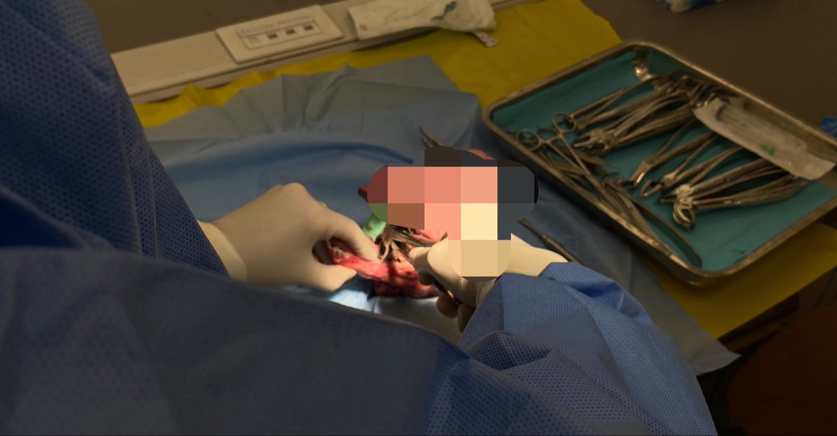 LamarAlamri445's tweet photo. Highlights from our “Extraction &amp; Suturing 101” workshop 🦷🪡
A great hands-on experience filled with learning, practice, and clinical skills development. Proud to be part of it! ✨ https://t.co/p0cqa9NrqH
