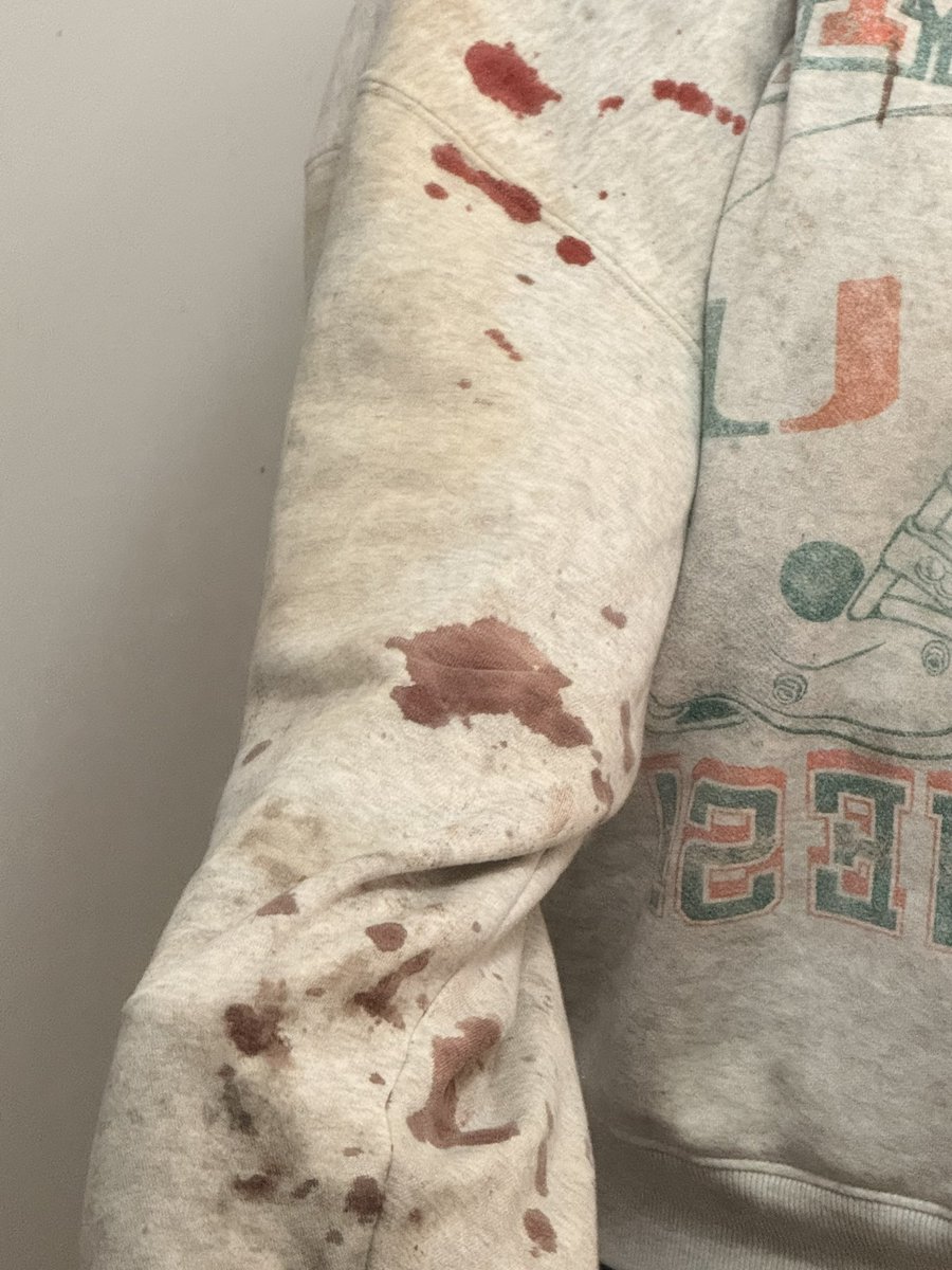 Queenofsaygon3's tweet photo. Aftermath
#HorrorMakeup
#HorrorMakeupArtist
#SFXMakeup
#SFXMakeupArtist
#SpecialEffectsMakeup
#CreatureMakeup
#GoreMakeup
#MonsterMakeup
#HalloweenMakeup
#ScaryMakeup
#CreepyMakeup
#HorrorTok
#shedtwt
#HorrorArtist
#HorrorCosplay
#fxmakeup https://t.co/ZCEn2YHeiD
