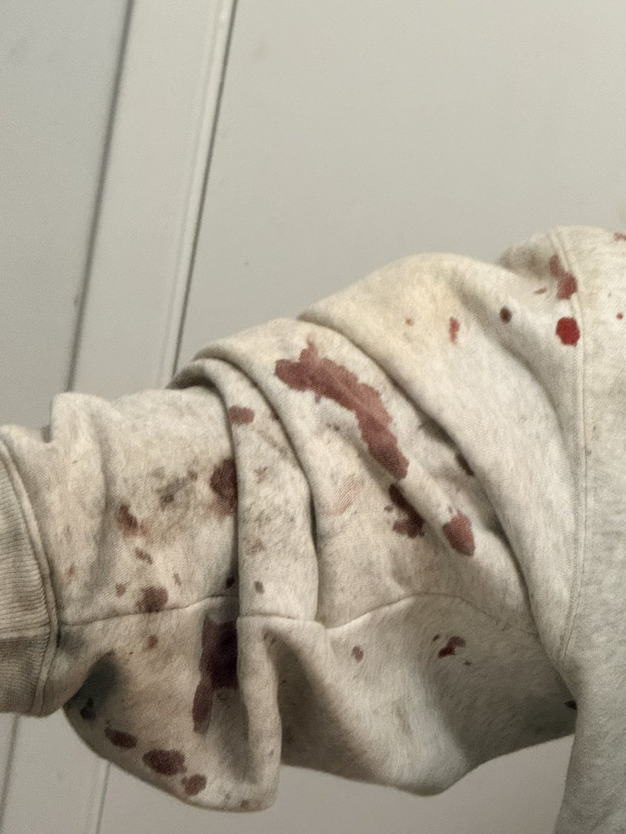 Queenofsaygon3's tweet photo. Aftermath
#HorrorMakeup
#HorrorMakeupArtist
#SFXMakeup
#SFXMakeupArtist
#SpecialEffectsMakeup
#CreatureMakeup
#GoreMakeup
#MonsterMakeup
#HalloweenMakeup
#ScaryMakeup
#CreepyMakeup
#HorrorTok
#shedtwt
#HorrorArtist
#HorrorCosplay
#fxmakeup https://t.co/ZCEn2YHeiD