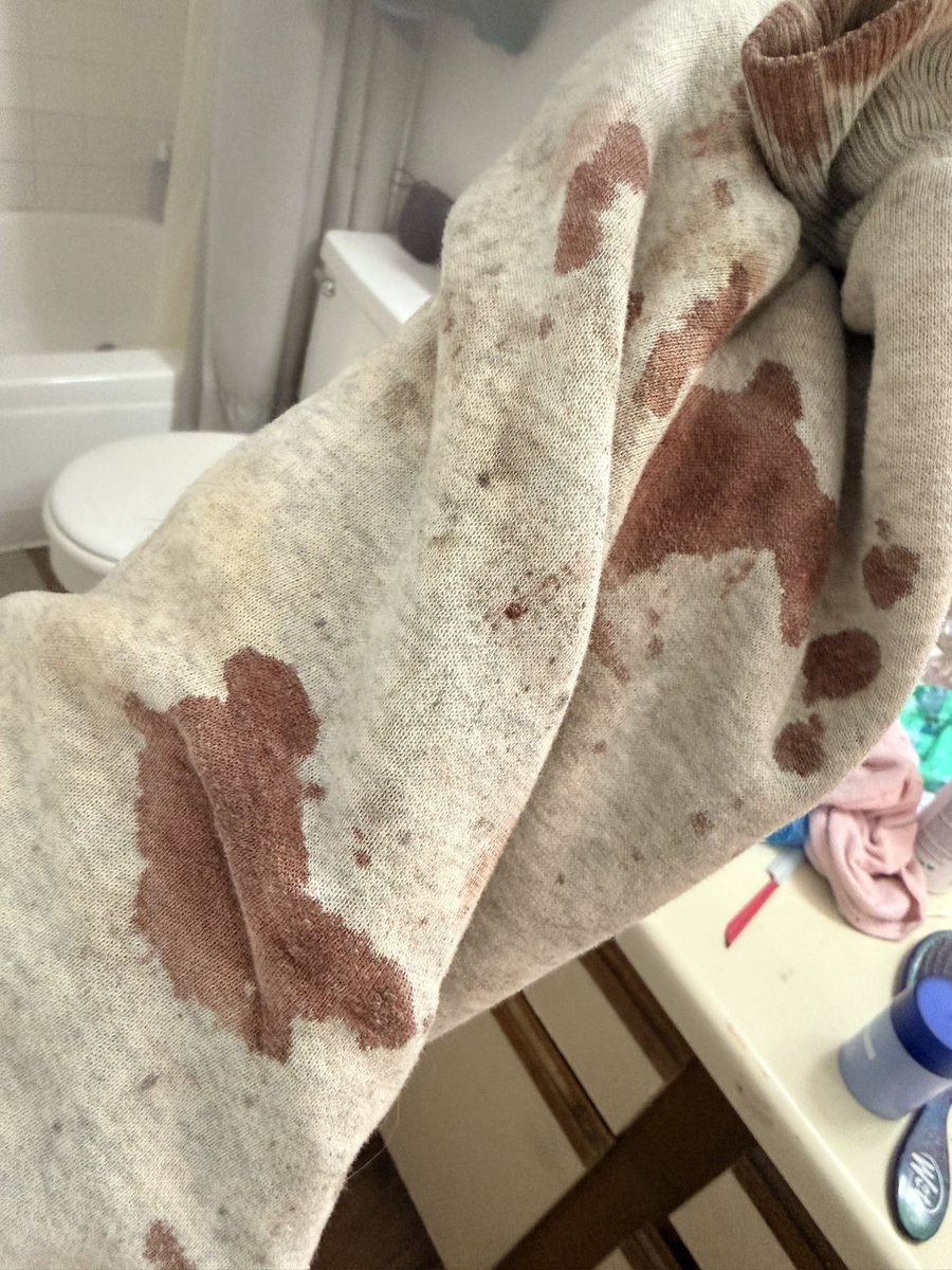 Queenofsaygon3's tweet photo. Aftermath
#HorrorMakeup
#HorrorMakeupArtist
#SFXMakeup
#SFXMakeupArtist
#SpecialEffectsMakeup
#CreatureMakeup
#GoreMakeup
#MonsterMakeup
#HalloweenMakeup
#ScaryMakeup
#CreepyMakeup
#HorrorTok
#shedtwt
#HorrorArtist
#HorrorCosplay
#fxmakeup https://t.co/ZCEn2YHeiD